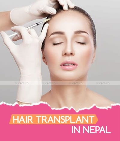 hair transplant nepal